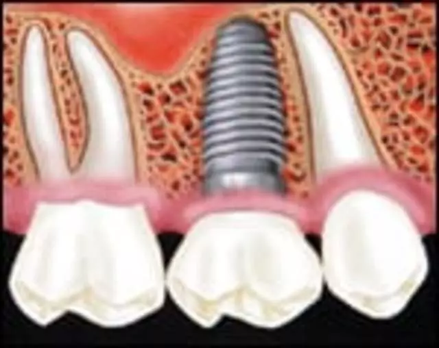 Afton Family Dental