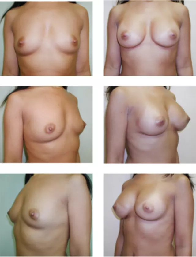 Adrian Lo, MD