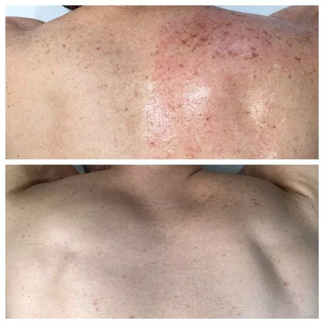 Kevin J Cross, MD
