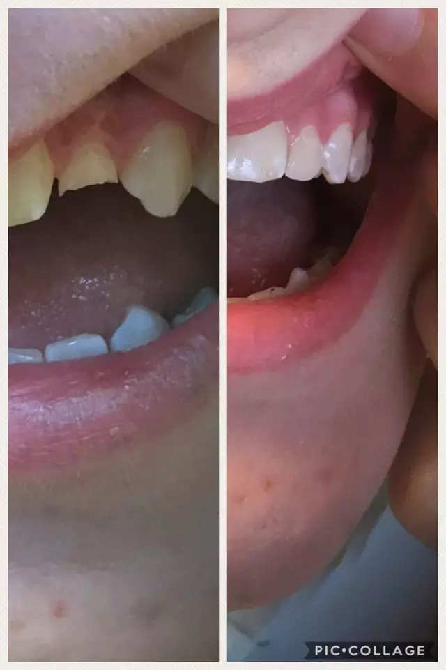 Absolute Smile